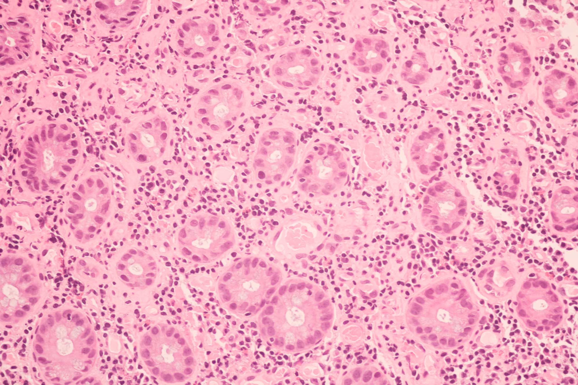 breast-tissue-cells-scan-provista-1223164084